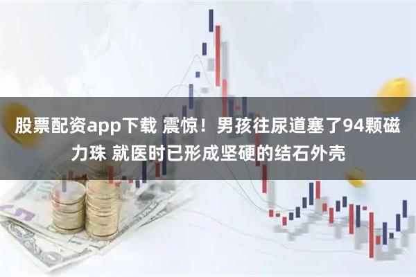 股票配资app下载 震惊！男孩往尿道塞了94颗磁力珠 就医时已形成坚硬的结石外壳